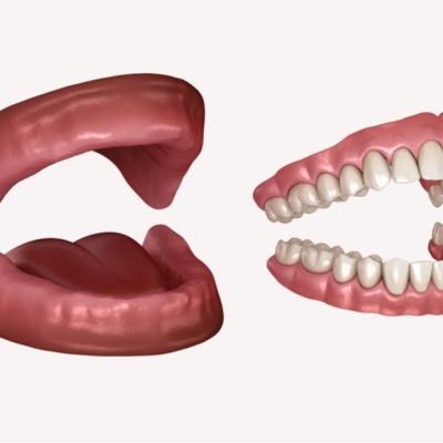 mobilne-proteze-intro